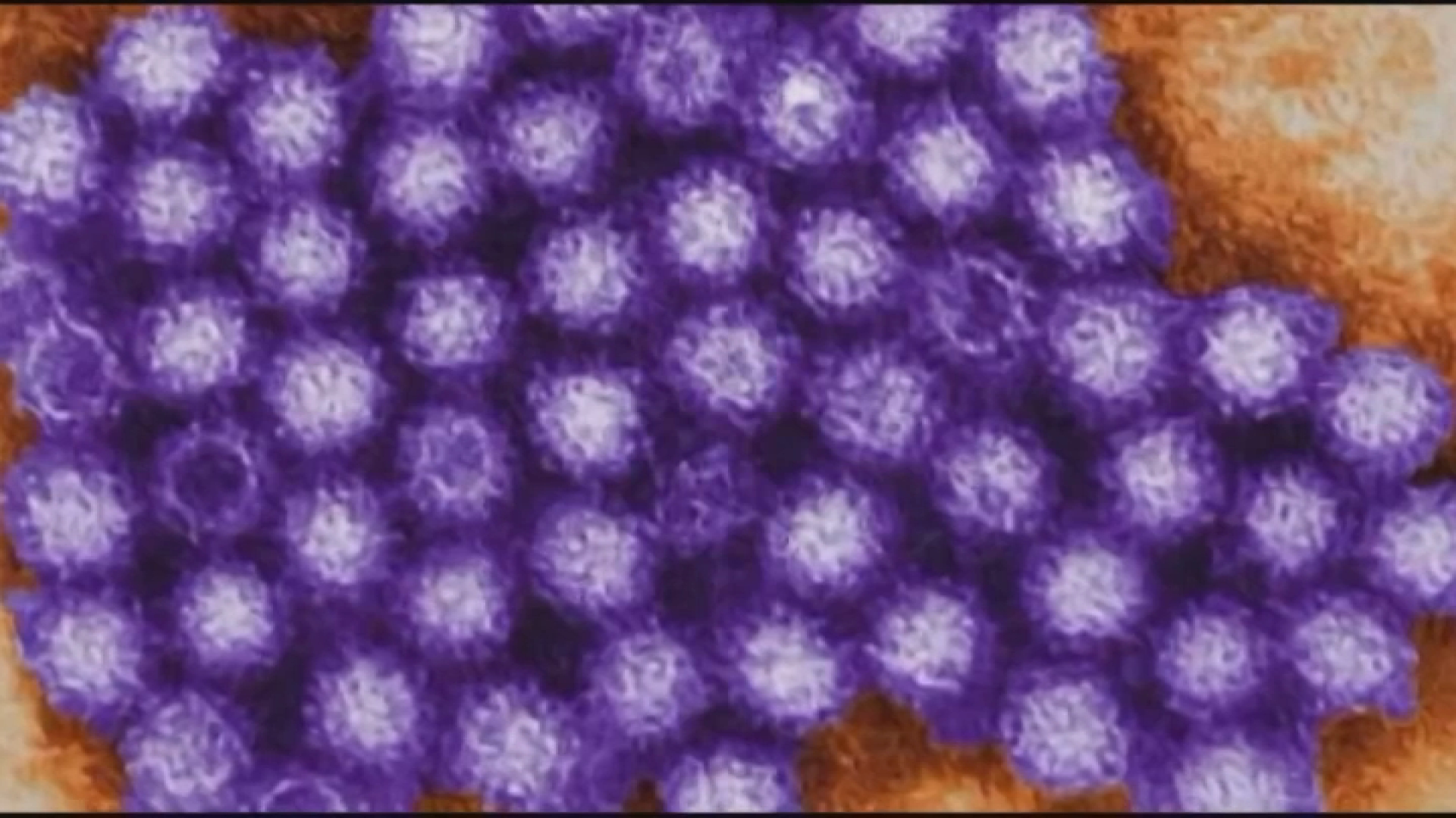 Norovirus expected to peak this winter as data shows earlier appearance
