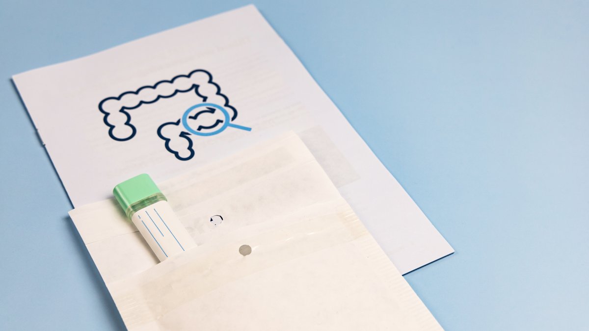 Rectal cancer deaths rising rapidly among millennials: ‘It's a medical crisis'