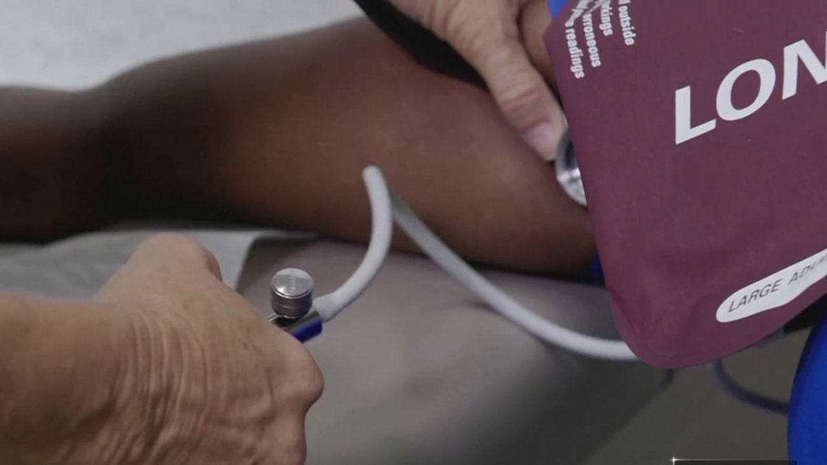 What is gestational hypertension? Understanding high blood pressure in pregnancy