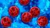 94 cases of cyclosporiasis have now been reported in Connecticut, DPH says