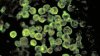 Girl, 8, dies from extremely rare brain-eating amoeba found in warm freshwater