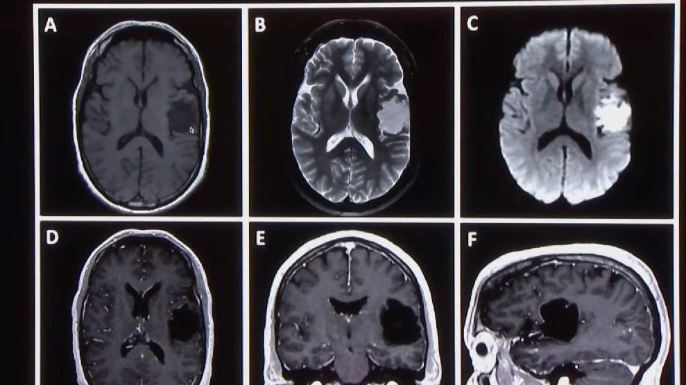 Boughton's Doctors Clear Mayor for Run for Governor