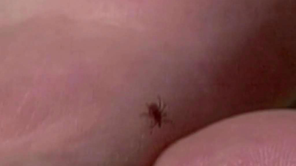 Healthcare Workers Warn to Look Out for Ticks
